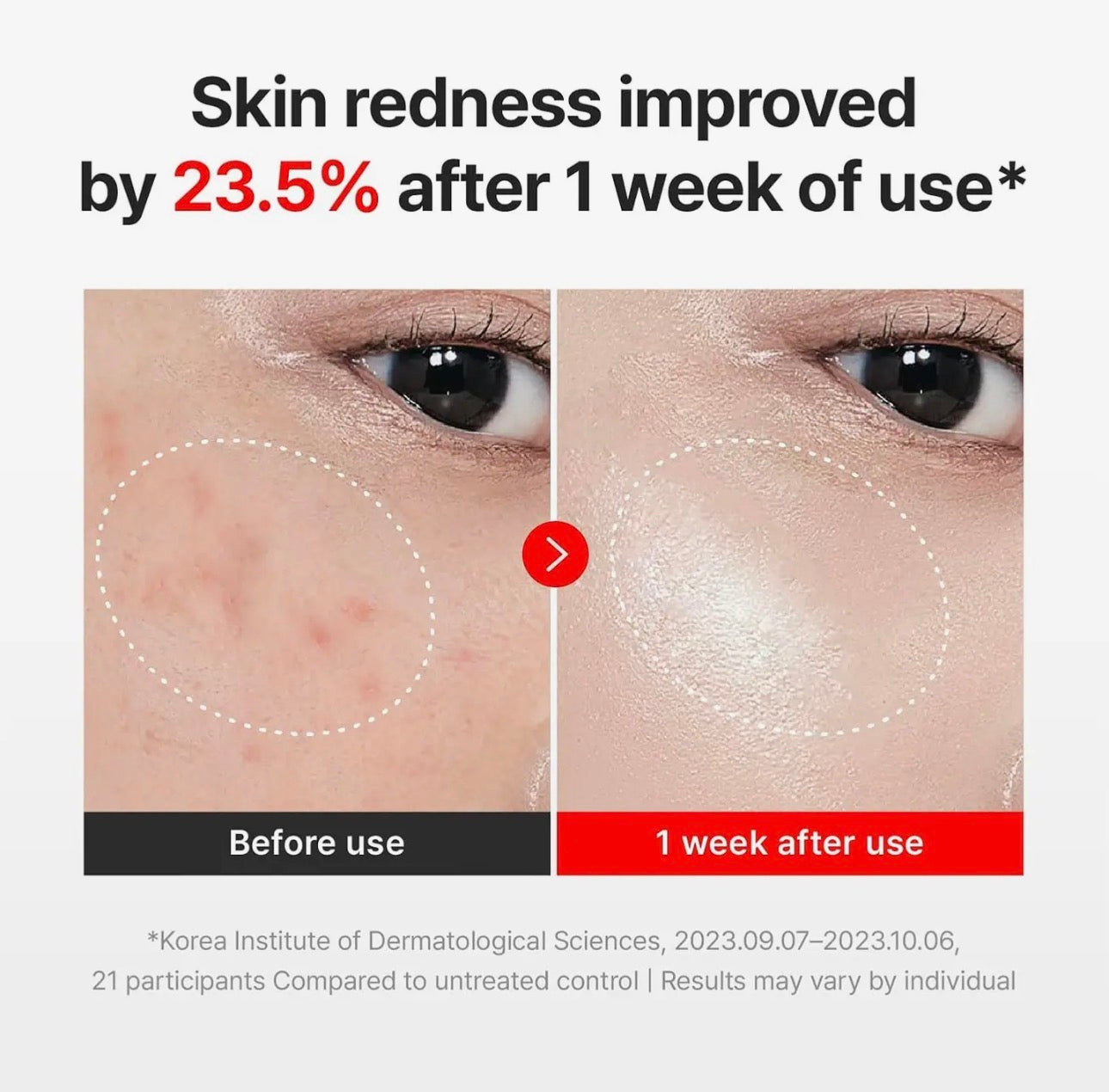 Centellian 24 Madeca Cream Time Reverse, Anti-Aging Korean Cream with Teca & Collagen