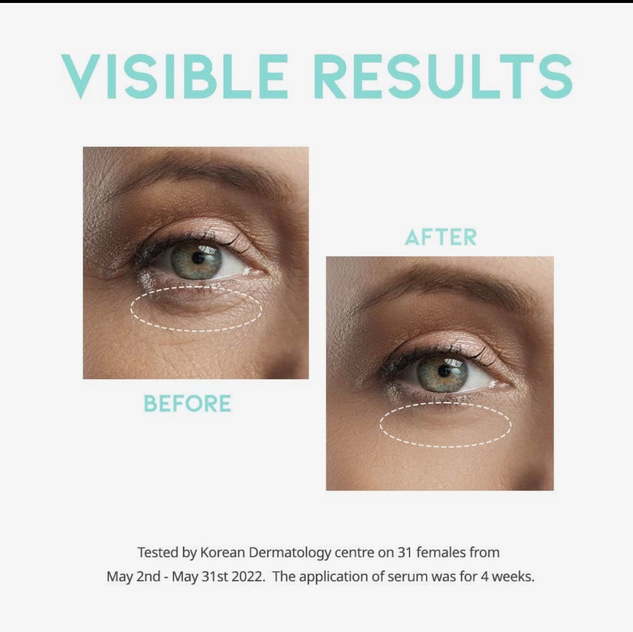 Ootd Wrinkle Lift Eye Serum